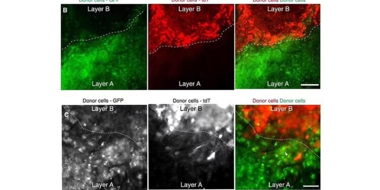 ABD Hükümeti’nden Beyin Nakli Araştırmalarına 110 Milyon Dolarlık Destek