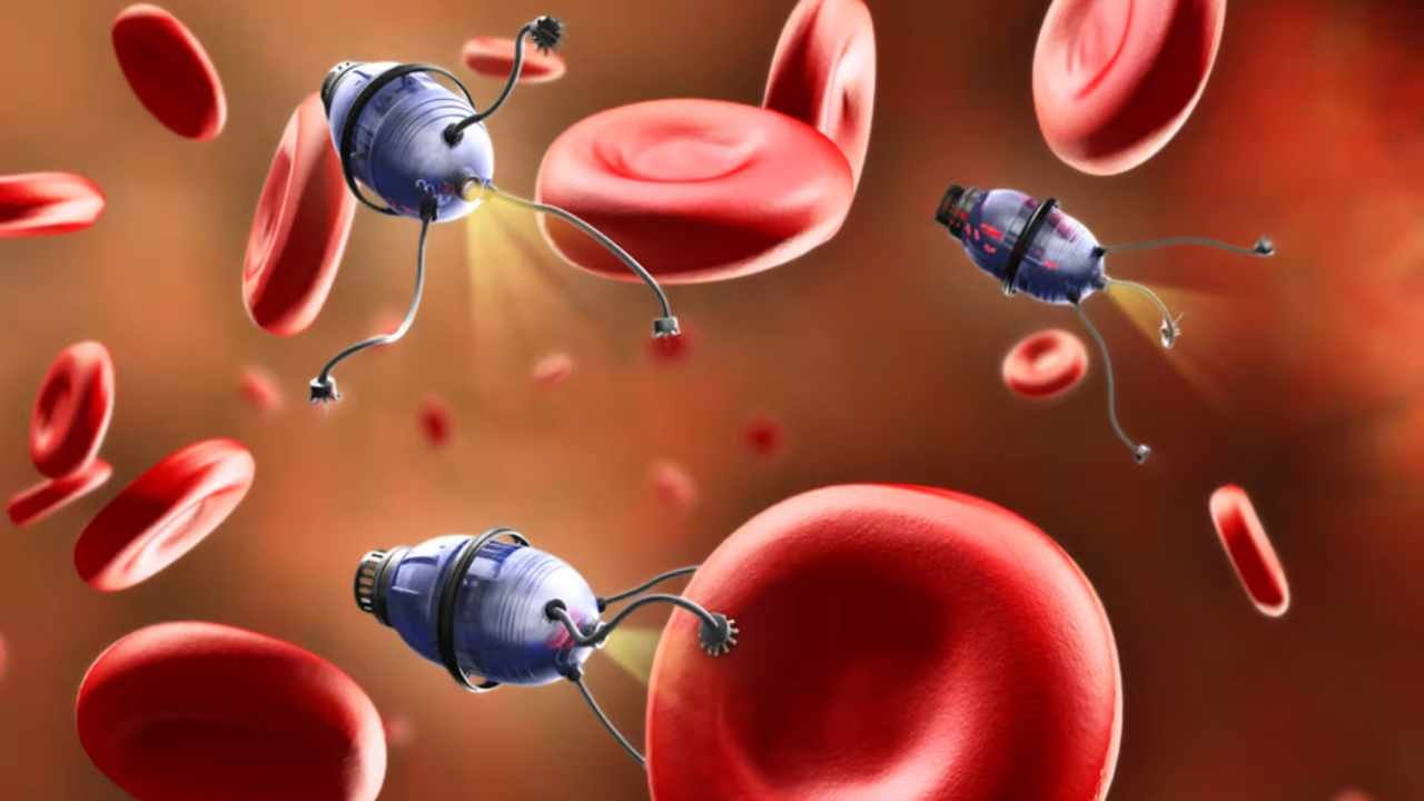 Beyin Anevrizması İçin Nanorobot Tedavisi: Yeni Bir Umut