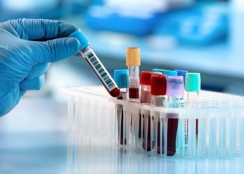 Yeni Tıbbi Test ile Enfeksiyon Teşhisinde Devrim