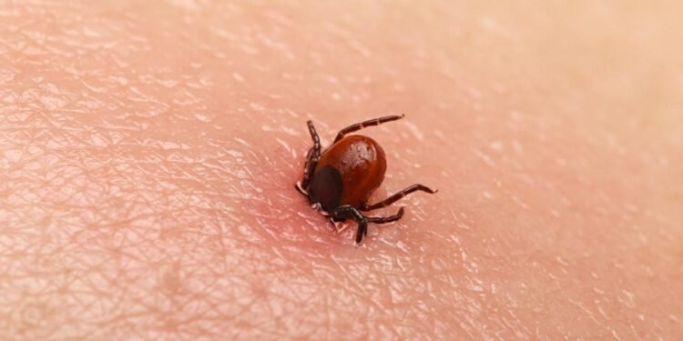 Kene Isırıklarının Ciddi Sağlık Etkileri: Bir Vaka Raporu