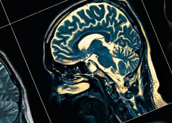 Çin’de Demans Vakalarındaki Hızlı Artış ve Küresel Etkileri