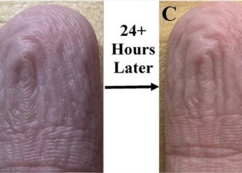 İnsan Parmaklarının Suya Daldırıldığında Oluşan Kırışıklıkların Gizemi ve Yeni Bulgular