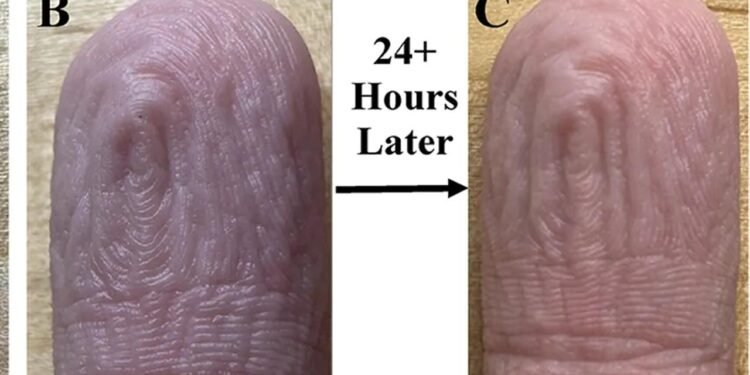 İnsan Parmaklarının Suya Daldırıldığında Oluşan Kırışıklıkların Gizemi ve Yeni Bulgular