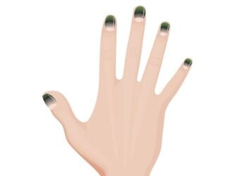 Yeşil Tırnak Sendromu Nedir ve Nasıl Tedavi Edilir?