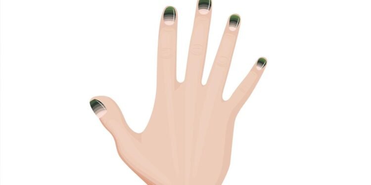 Yeşil Tırnak Sendromu Nedir ve Nasıl Tedavi Edilir?