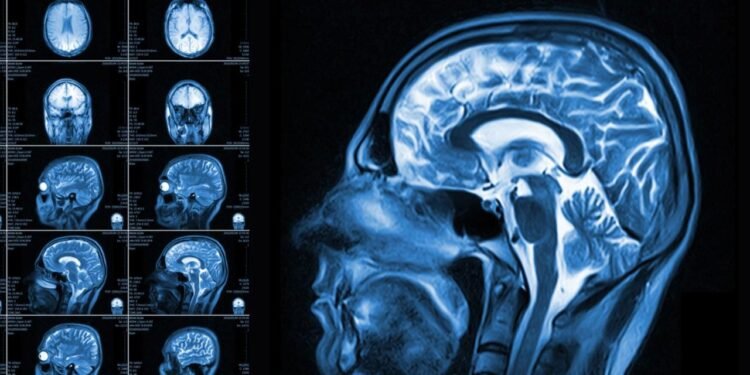 Beynimiz hakkında yeni keşif: Gördüğüne değil, beklediğine inanıyor!